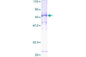 Image no. 1 for Cyclin E2 (CCNE2) (AA 1-374) protein (GST tag) (ABIN1348463) (Cyclin E2 Protein (CCNE2) (AA 1-374) (GST tag))