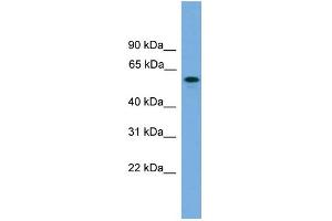 WB Suggested Anti-KIAA1609 Antibody Titration: 0.