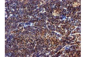 Image no. 6 for anti-EPM2A (Laforin) Interacting Protein 1 (EPM2AIP1) antibody (ABIN1498045) (EPM2AIP1 抗体)