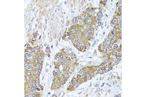 Immunohistochemistry (Paraffin-embedded Sections) (IHC (p)) image for anti-Peroxisomal Biogenesis Factor 14 (PEX14) (AA 118-377) antibody (ABIN6145458)