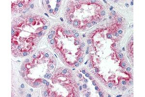 Immunohistochemistry (IHC) image for anti-Solute Carrier Family 5 (Sodium/inositol Cotransporter), Member 11 (SLC5A11) (Internal Region) antibody (ABIN1049343)