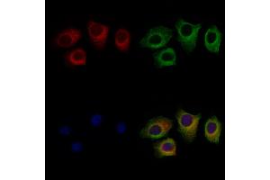 ABIN6257343 and ABIN6275522 staining HepG2 cells by IF/ICC.