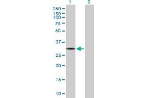 Western Blot analysis of MTFMT expression in transfected 293T cell line by MTFMT MaxPab polyclonal antibody. (MTFMT 抗体  (AA 1-304))