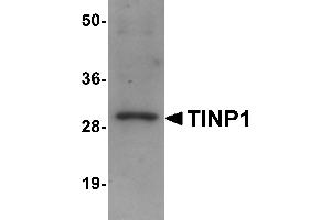 Western Blotting (WB) image for anti-NSA2 Ribosome Biogenesis Homolog (NSA2) (C-Term) antibody (ABIN1030737) (NSA2 抗体  (C-Term))