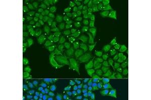 Immunofluorescence analysis of U2OS cells using ATPIF1 Polyclonal Antibody at dilution of 1:100. (ATPase Inhibitory Factor 1 抗体)