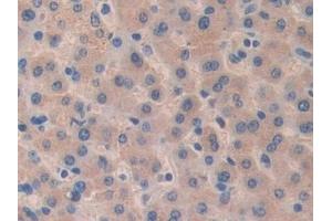 Immunohistochemistry (IHC) image for anti-Sema Domain, Immunoglobulin Domain (Ig), Short Basic Domain, Secreted, (Semaphorin) 3A (SEMA3A) (AA 580-664) antibody (ABIN7430102)