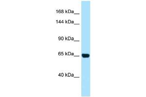 WB Suggested Anti-PALB2 AntibodyTitration: 1. (PALB2 抗体  (N-Term))