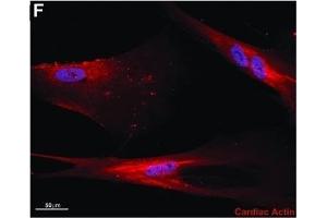 Immunofluorescence (Cultured Cells) (IF (cc)) image for anti-Actin, Alpha, Cardiac Muscle 1 (ACTC1) antibody (ABIN2855212)