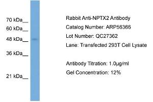 WB Suggested Anti-NPTX2  Antibody Titration: 0. (NPTX2 抗体  (Middle Region))