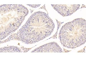 Detection of GLb in Mouse Testis Tissue using Polyclonal Antibody to Galactosidase Beta (GLb) (GLB1 抗体  (AA 192-432))