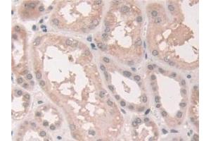 Detection of NCOA3 in Human Kidney Tissue using Polyclonal Antibody to Nuclear Receptor Coactivator 3 (NCOA3)
