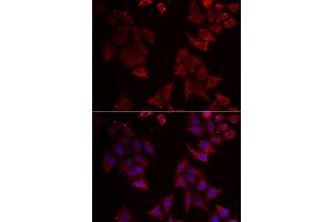 Immunofluorescence analysis of U2OS cells using NCR1 antibody (ABIN5973838). (NCR1 抗体)