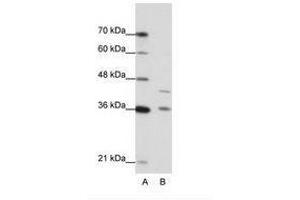Image no. 1 for anti-Naked Cuticle Homolog 2 (NKD2) (AA 43-92) antibody (ABIN6736218) (NKD2 抗体  (AA 43-92))