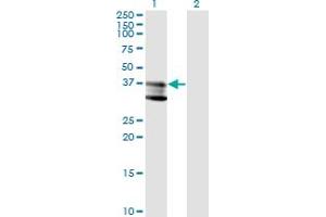 Western Blot analysis of SMPD1 expression in transfected 293T cell line by SMPD1 monoclonal antibody (M01), clone 4H2. (SMPD1 抗体  (AA 1-364))