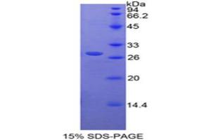 SDS-PAGE analysis of Rat RARa Protein. (Retinoic Acid Receptor alpha 蛋白)