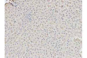 Immunohistochemistry (IHC) image for anti-DEAD (Asp-Glu-Ala-Asp) Box Polypeptide 5 (DDX5) antibody (ABIN1876484) (DDX5 抗体)