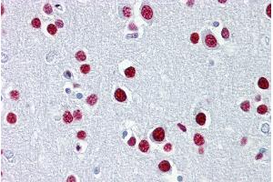 Immunohistochemistry with Brain, cortex tissue at an antibody concentration of 5µg/ml using anti-TUB antibody (ARP33467_P050) (TUB 抗体  (N-Term))