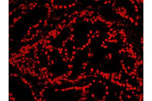Immunofluorescence (IF) image for anti-cAMP Responsive Element Binding Protein 1 (CREB1) (AA 250-300) antibody (ABIN7448947) (CREB1 抗体  (AA 250-300))