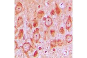 Immunohistochemistry (IHC) image for anti-Proto-oncogene tyrosine-protein kinase Src (Src) (N-Term), (pSer75) antibody (ABIN7297010)