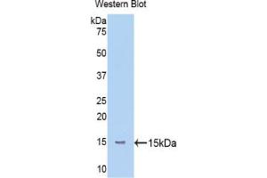 Western blot analysis of the recombinant protein. (Mannose Associated Serine Protease 2 (AA 170-287) 抗体)