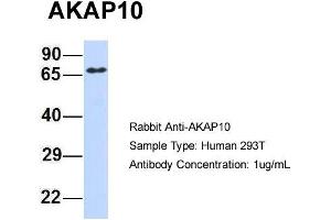 Host: Rabbit Target Name: AKAP10 Sample Type: 293T Antibody Dilution: 1. (AKAP10 抗体  (Middle Region))