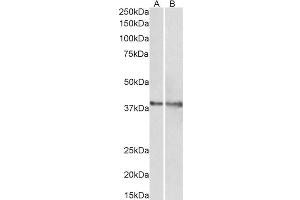 ABIN768559 (1µg/ml) staining of Rat (A) and Pig (B) Heart lysate (35µg protein in RIPA buffer). (IDH3G 抗体  (AA 337-350))