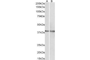 ABIN768559 (1µg/ml) staining of Rat (A) and Pig (B) Heart lysate (35µg protein in RIPA buffer).