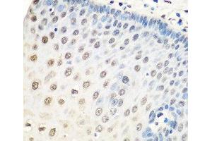 Immunohistochemistry of paraffin-embedded Human esophagus using HNRNPA0 Polyclonal Antibody at dilution of 1:100 (40x lens). (HNRNPA0 抗体)