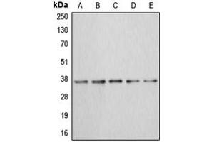 Western blot analysis of Annexin A3 expression in MCF7 (A), HEK293T (B), HepG2 (C), mouse kidney (D), rat liver (E) whole cell lysates. (Annexin A3 抗体  (Center))
