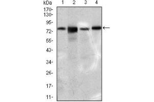 Western Blotting (WB) image for anti-Solute Carrier Family 27 (Fatty Acid Transporter), Member 5 (SLC27A5) (AA 508-570) antibody (ABIN1845743) (SLC27A5 抗体  (AA 508-570))