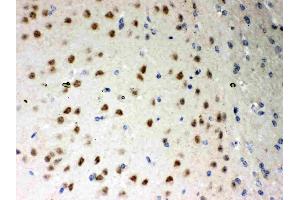 Immunohistochemistry (IHC) image for anti-Protein Kinase C, iota (PRKCI) (AA 21-214) antibody (ABIN3043909)