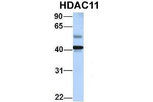 Host:  Rabbit  Target Name:  HDAC11  Sample Type:  Human Adult Placenta  Antibody Dilution:  1. (HDAC11 抗体  (Middle Region))