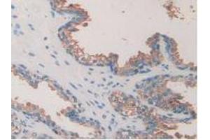 IHC-P analysis of Human Prostate Gland Tissue, with DAB staining. (TOR1A 抗体  (AA 33-321))