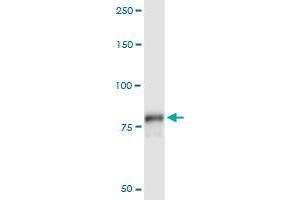 Immunoprecipitation of PLA2G6 transfected lysate using anti-PLA2G6 MaxPab rabbit polyclonal antibody and Protein A Magnetic Bead , and immunoblotted with PLA2G6 purified MaxPab mouse polyclonal antibody (B01P) . (PLA2G6 抗体  (AA 1-752))