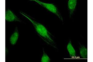 Immunofluorescence (IF) image for anti-CTD (Carboxy-terminal Domain, RNA Polymerase II, Polypeptide A) Phosphatase, Subunit 1 (CTDP1) (AA 332-431) antibody (ABIN522613)
