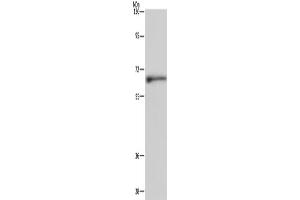 Western Blotting (WB) image for anti-Elastin (ELN) antibody (ABIN2421530) (Elastin 抗体)