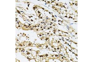 Immunohistochemistry (Paraffin-embedded Sections) (IHC (p)) image for anti-Proteasome (Prosome, Macropain) Subunit, beta Type, 1 (PSMB1) (AA 29-241) antibody (ABIN6146309)