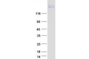 Validation with Western Blot