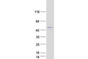 Western Blotting (WB) image for Calcium Binding tyrosine-(Y)-phosphorylation Regulated (CABYR) (Transcript Variant 1) protein (Myc-DYKDDDDK Tag) (ABIN2713005)