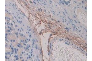 Detection of FBN1 in Rat Stomach Tissue using Polyclonal Antibody to Fibrillin 1 (FBN1) (Fibrillin 1 抗体  (AA 751-895))