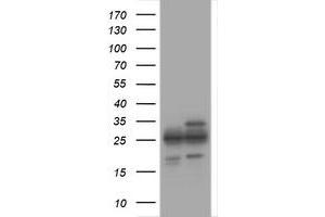 Image no. 1 for anti-Proteasome Subunit alpha 2 (PSMA2) (AA 50-234) antibody (ABIN1491570) (PSMA2 抗体  (AA 50-234))