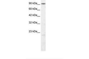 Image no. 2 for anti-Ligase IV, DNA, ATP-Dependent (LIG4) (AA 275-324) antibody (ABIN202951) (LIG4 抗体  (AA 275-324))