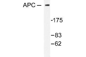 Image no. 1 for anti-Adenomatous Polyposis Coli (APC) antibody (ABIN265313) (APC 抗体)