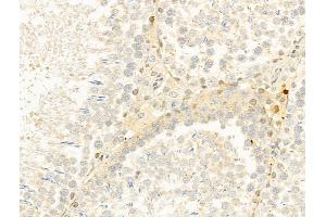 ABIN6261163 and ABIN6273037 at 1/100 staining Rat testis tissue by IHC-P. (CYLD 抗体  (C-Term))