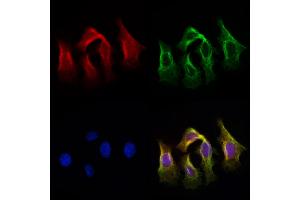 ABIN6259832 and ABIN6279098 staining Hela cells by IF/ICC. (AGXT2 抗体  (Internal Region))