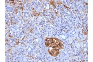 Immunohistochemistry (IHC) image for anti-Ferritin, Light Polypeptide (FTL) (AA 38-165) antibody (ABIN6939458)