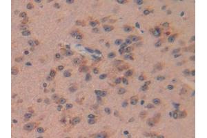 DAB staining on IHC-P; Samples: Mouse Brain Tissue (Pituitary Adenylate Cyclase Activating Peptide (AA 1-175) 抗体)