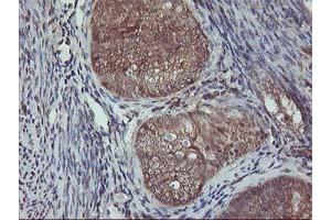 Image no. 1 for anti-V-Akt Murine Thymoma Viral Oncogene Homolog 1 (AKT1) antibody (ABIN1496554) (AKT1 抗体)