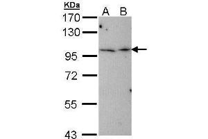 WB Image Sample (30 ug of whole cell lysate) A: Hep G2 , B: Molt-4 , 7. (TBCK 抗体)
