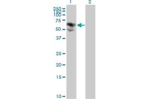 Western Blot analysis of BTD expression in transfected 293T cell line by BTD monoclonal antibody (M01), clone 3B10-2B3. (BTD 抗体  (AA 1-543))